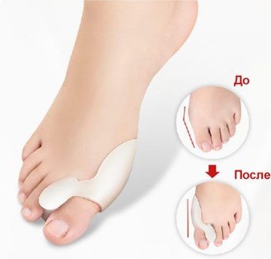 Фиксатор для коррекции деформации большого пальца Valgus Pro Вальгус Про - фото